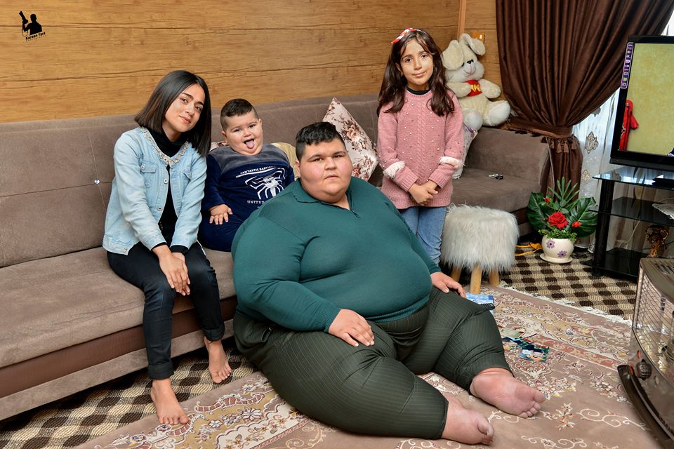 Family in Kurdistan Region seeks medical help abroad to treat obese children 
